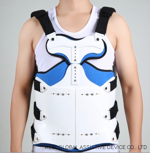 Thoracolumbar Sacral Orthosis Thoracic Lumbar Sacral Orthosis thoracolumbar-sacral-orthosis-thoracic-lumbar-sacral-orthosis