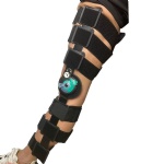 Post-op Knee Brace