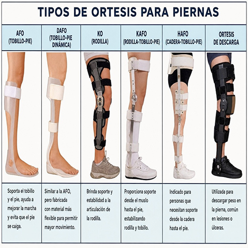 Ortesis de Miembros Inferiores: Beneficios y Avances Tecnológicos