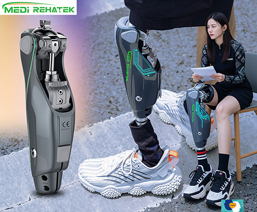 Prothesenknie 2025 im Vergleich: Smart, hydraulisch oder mechanisch? Auswahlhilfe für die Orthopädische Werkstatt