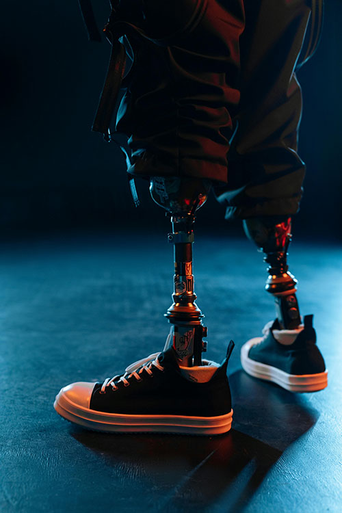 Understanding Prosthetic Components: Sockets, Joints, and Control Systems